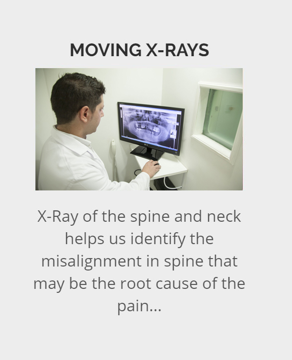 moving x ray